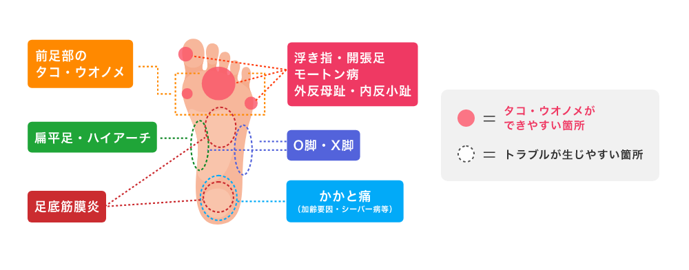 医学博士監修フットサポーターのセルフチェック