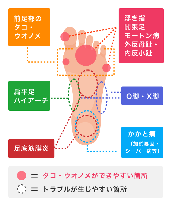 医学博士監修フットサポーターのセルフチェック