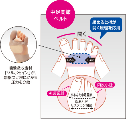 外反母趾サポーター| ソルボバランスウォーク オープントゥガード