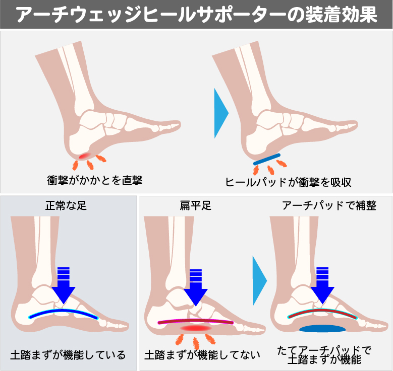 足底筋膜炎サポーター | ソルボアーチウェッジヒールサポーター 薄型