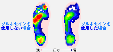 子供用シューズインソール シーバー病 踵骨骨端症|ソルボ