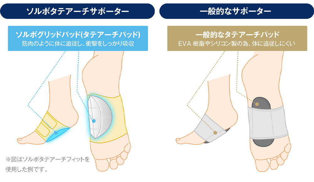 ソルボタテアーチサポーターを装着すると・・・