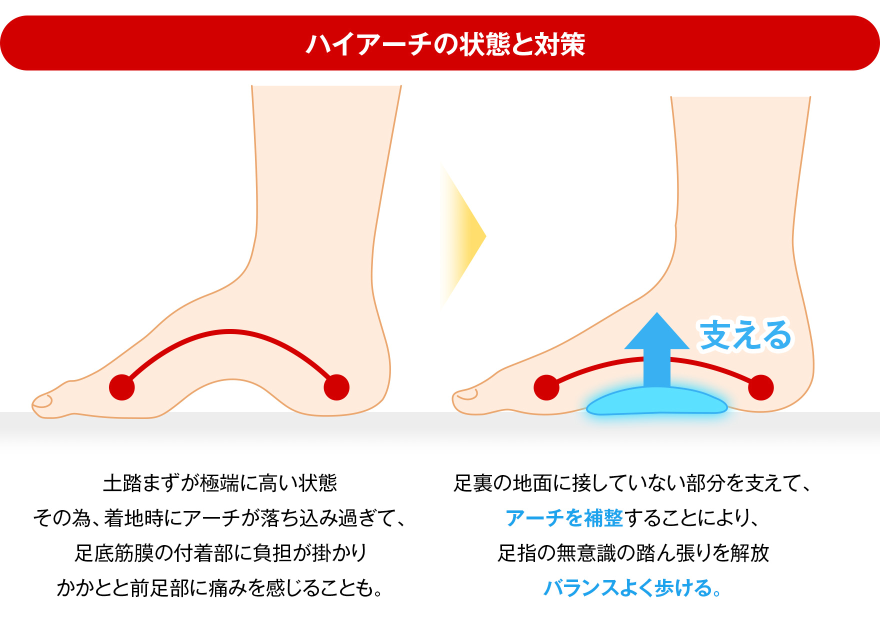 ハイアーチの場合