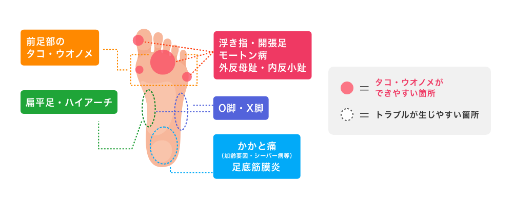 医学博士監修フットサポーターのセルフチェック