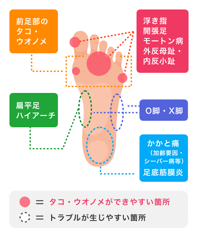 医学博士監修フットサポーターのセルフチェック