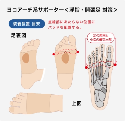 ヨコアーチのパッド装着位置